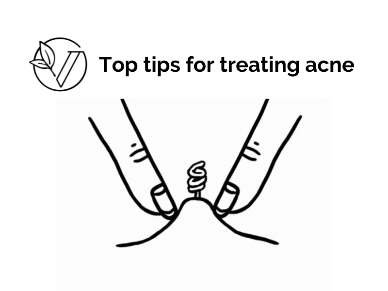 Top tips for treating acne Vinka supplements