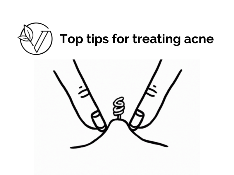 Top tips for treating acne